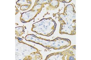 Immunohistochemistry of paraffin-embedded human placenta using Placental alkaline phosphatase (PLAP) antibody (ABIN6127420, ABIN6136826, ABIN6136827 and ABIN6221966) at dilution of 1:100 (40x lens). (PLAP anticorps  (AA 260-460))