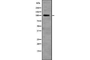 Western blot analysis of RALGDS expression in Liver (Human) Tissue Lysate ,The lane on the left is treated with the antigen-specific peptide. (RALGDS anticorps  (N-Term))