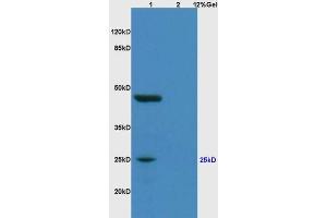Lane 1: human colon carcinoma lysates Lane 2: rat brain lysates probed with Anti MYOG/Myogenin Polyclonal Antibody, Unconjugated (ABIN700660) at 1:200 in 4 °C.