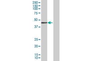 Western Blot analysis of GLI4 expression in transfected 293T cell line by GLI4 MaxPab polyclonal antibody.