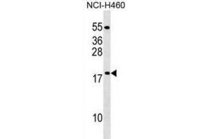 Western Blotting (WB) image for anti-Mitochondrial Ribosomal Protein L54 (MRPL54) antibody (ABIN2999653) (MRPL54 anticorps)