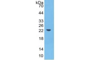 WB of Protein Standard: different control antibodies against Highly purified E.