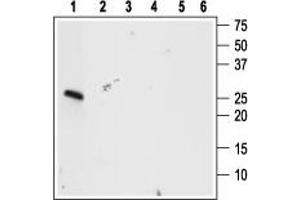 Western blot analysis using Anti-proBDNF Antibody (ABIN7043558, ABIN7044753 and ABIN7044754), (1:400): - 1. (Pro BDNF anticorps  (Pro-Domain))