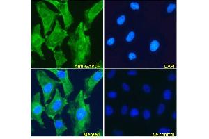 ABIN185543 Immunofluorescence analysis of paraformaldehyde fixed HeLa cells, permeabilized with 0.