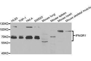 Western blot analysis of extracts of various cell lines, using IFNGR1 antibody (ABIN5973372) at 1/1000 dilution. (IFNGR1 anticorps)