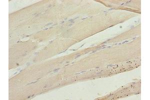 Immunohistochemistry of paraffin-embedded human skeletal muscle tissue using ABIN7146719 at dilution of 1:100 (CA3 anticorps  (AA 2-260))