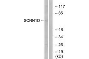 Western Blotting (WB) image for anti-Sodium Channel, Nonvoltage-Gated 1, delta (SCNN1D) (AA 411-460) antibody (ABIN2890112) (SCNN1D anticorps  (AA 411-460))