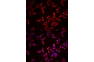 Immunofluorescence analysis of U2OS cells using NCR3 antibody (ABIN5974302). (NCR3 anticorps)
