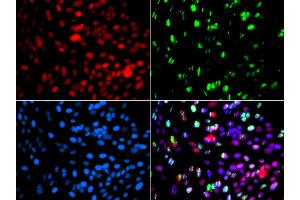 Immunofluorescence analysis of GFP-RNF168 transgenic U2OS cells using POLD3 antibody (ABIN5974362). (POLD3 anticorps)