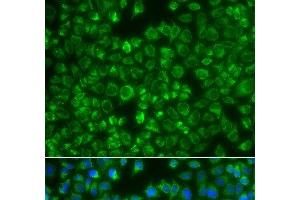 Immunofluorescence analysis of A549 cells using MTMR4 Polyclonal Antibody (MTMR4 anticorps)