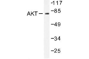 Image no. 1 for anti-V-Akt Murine Thymoma Viral Oncogene Homolog 1 (AKT1) antibody (ABIN271988) (AKT1 anticorps)