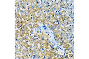Immunohistochemistry of paraffin-embedded rat liver using HD antibody (ABIN6133742, ABIN6141675, ABIN6141678 and ABIN6213911) at dilution of 1:100 (40x lens). (HDAC5 anticorps  (AA 550-650))