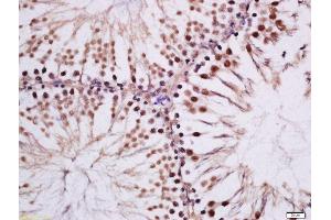 Formalin-fixed and paraffin embedded rat testis tissue labeled with Rabbit Anti-MAK (Tyr159) Polyclonal Antibody, Unconjugated (ABIN2559531) at 1:200 followed by conjugation to the secondary antibody and DAB staining