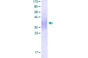 Image no. 1 for CD47 (CD47) (AA 19-141) protein (His-DYKDDDDK-Strep II Tag) (ABIN2752751)