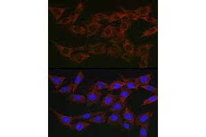 Immunofluorescence analysis of NIH/3T3 cells using WNK3 Rabbit pAb (ABIN7271382) at dilution of 1:200 (40x lens).