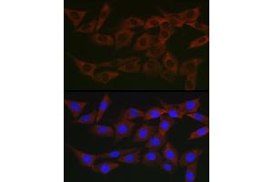 Immunofluorescence analysis of NIH/3T3 cells using WNK3 Rabbit pAb (ABIN7271382) at dilution of 1:200 (40x lens). (WNK3 anticorps  (AA 500-600))