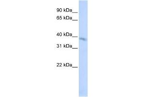 WB Suggested Anti-TMEM82 Antibody Titration:  0. (TMEM82 anticorps  (N-Term))