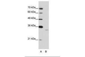 Image no. 1 for anti-Exosome Component 6 (EXOSC6) (N-Term) antibody (ABIN6736212) (EXOSC6 anticorps  (N-Term))