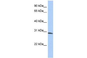 WB Suggested Anti-ZFYVE28 Antibody Titration:  0. (ZFYVE28 anticorps  (N-Term))
