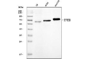 Western blot analysis of TFEB using anti-TFEB antibody (ABIN7601914).