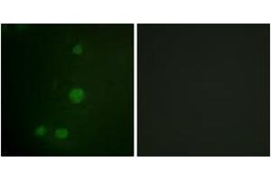 Immunofluorescence analysis of HuvEc cells, using Retinoblastoma (Ab-811) Antibody. (Retinoblastoma Protein (Rb) anticorps  (AA 771-820))