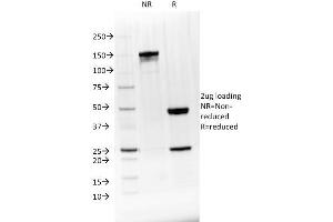 SDS-PAGE Analysis Purified BTLA Mouse Monoclonal Antibody (BTLA/1528). (BTLA anticorps)