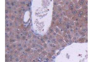 Detection of ALDH1A1 in Mouse Liver Tissue using Polyclonal Antibody to Aldehyde Dehydrogenase 1 Family, Member A1 (ALDH1A1)