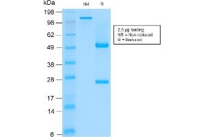 SDS-PAGE Analysis of Purified CK HMW Mouse Recombinant Monoclonal Antibody (rKRTH/2148).