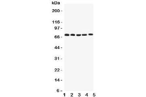 Western blot testing of Kv1. (Kv1.4 anticorps  (Middle Region))