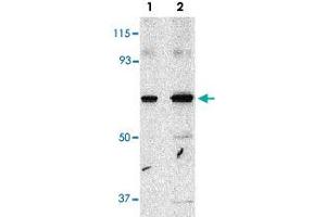 Western blot analysis of PAK4 in SW480 cell lysate with PAK4 polyclonal antibody  at 1 and 2 ug/mL . (PAK4 anticorps  (Internal Region))