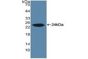 Detection of Recombinant ARO, Human using Polyclonal Antibody to Aromatase (ARO) (Aromatase anticorps  (AA 196-373))