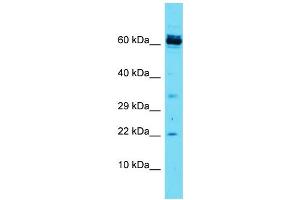 Host: Rabbit Target Name: CCDC115 Sample Type: Jurkat Whole Cell lysates Antibody Dilution: 1.
