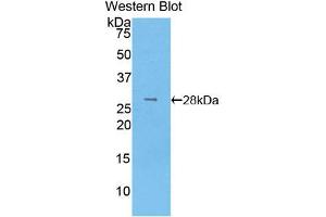 Western blot analysis of the recombinant protein. (LOXL3 anticorps  (AA 519-726))