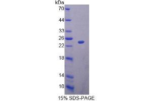 SDS-PAGE analysis of Rat MRPL1 Protein. (MRPL1 Protéine)