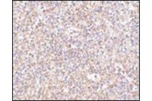 Immunohistochemistry of STEAP1 in human spleen tissue AP30832PU-N antibody at 2.