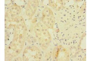 Immunohistochemistry of paraffin-embedded human kidney tissue using ABIN7142304 at dilution of 1:100 (BDH2 anticorps  (AA 1-245))