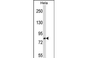 TRIM37 Antibody (C-term) (ABIN657211 and ABIN2846321) western blot analysis in Hela cell line lysates (35 μg/lane). (TRIM37 anticorps  (C-Term))