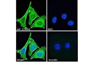 ABIN2613478 Immunofluorescence analysis of paraformaldehyde fixed HeLa cells, permeabilized with 0.