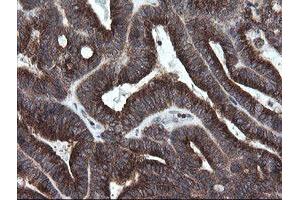 Image no. 5 for anti-Golgin, RAB6-Interacting (GORAB) (AA 35-394) antibody (ABIN1491441)