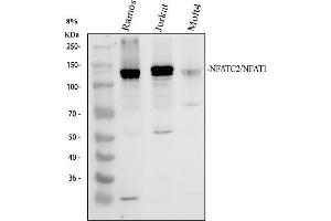 Western blot analysis of NFAT1/NFATC2 using anti-NFAT1/NFATC2 antibody (ABIN5519044).