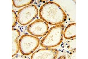 anti-Caspase 2, Apoptosis-Related Cysteine Peptidase (CASP2) (AA 198-226) antibody