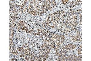 IHC analysis of HSPD1 using anti-HSPD1 antibody (ABIN7600976). (HSPD1 anticorps  (AA 260-496))