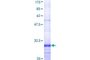 Image no. 1 for Formyl Peptide Receptor 2 (FPR2) (AA 163-205) protein (GST tag) (ABIN1354417)