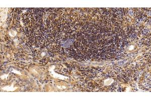 Detection of IL17 in Human Kidney Tissue using Monoclonal Antibody to Interleukin 17 (IL17)