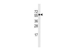 Western blot analysis of anti-CYP4A11 (4A22) Antibody in NCI-H460 cell line lysates (35ug/lane).