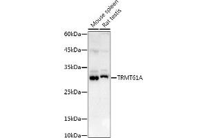 Western blot analysis of extracts of various cell lines, using TRMT61A antibody (ABIN6132806, ABIN6149558, ABIN6149559 and ABIN6214904) at 1:1000 dilution. (TRMT61A anticorps  (AA 1-289))
