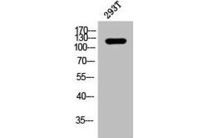 Western Blot analysis of 293T cells using Phospho-p120 (Y228) Polyclonal Antibody (CTNND1 anticorps  (pTyr228))