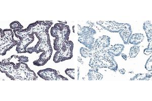 Immunohistochemistry (IHC) image for anti-Receptor Tyrosine-Protein Kinase ErbB-3 (ERBB3) antibody (ABIN967437) (ERBB3 anticorps)