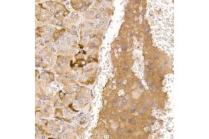 Immunohistochemistry of paraffin-embedded mouse adrenal gland using AGRP Rabbit pAb (ABIN7265515) at dilution of 1:50 (40x lens).