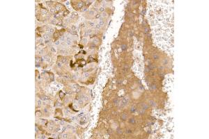 Immunohistochemistry of paraffin-embedded mouse adrenal gland using AGRP Rabbit pAb (ABIN7265515) at dilution of 1:50 (40x lens). (AGRP anticorps  (AA 21-132))